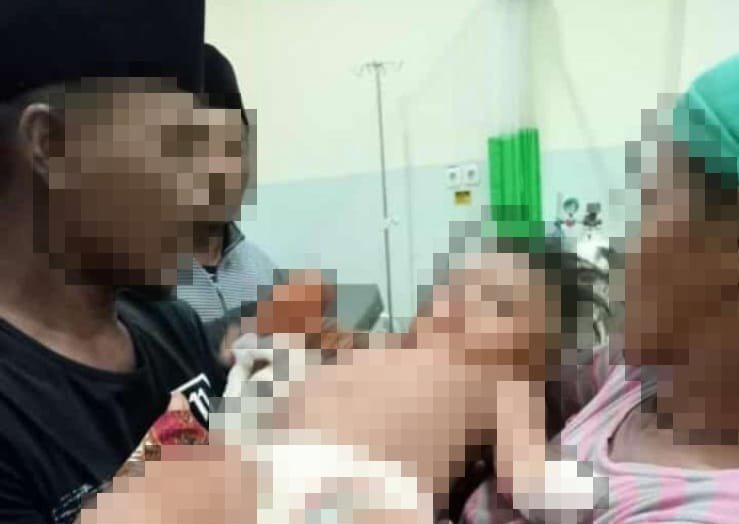 Tergilas Mesin Rajang Tembakau, Tangan Balita di Sampang Putus