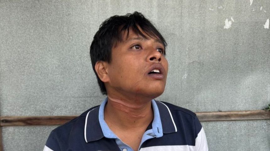 Kronologi Pemotor Terjerat Kabel Wifi di Talango, Sudah Dilaporkan ke Lakalantas Polres Sumenep